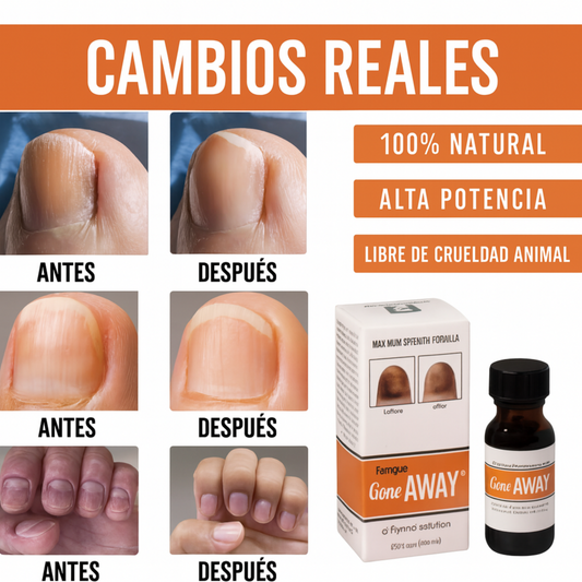 Gone Away – Gotero Anti-Hongos para Uñas Perfectas